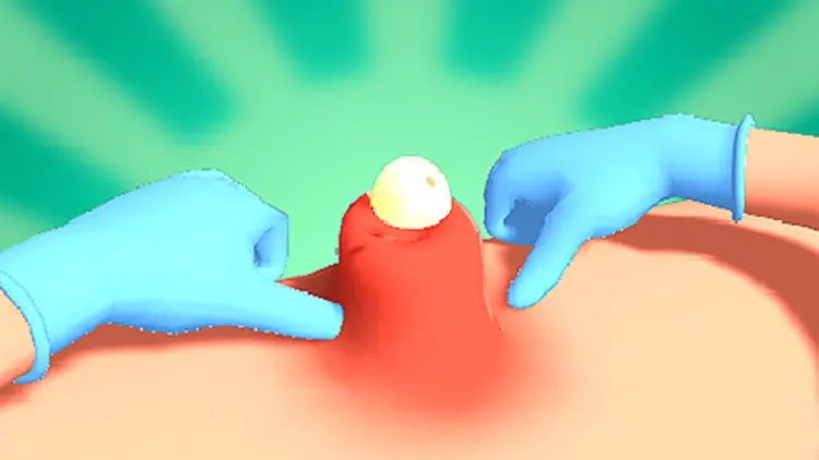 pimple-squeeze